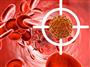 درمان قطعی سرطان مزمن خون با پیوند سلول‌های استخوانی